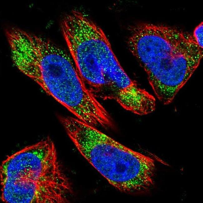 DLC1 Antibody in Immunocytochemistry (ICC/IF)