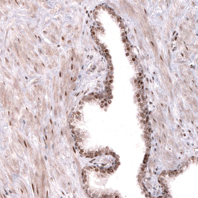 TNRC6A Antibody in Immunohistochemistry (IHC)