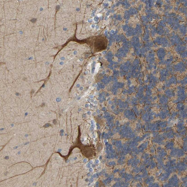 BEND3 Antibody in Immunohistochemistry (Paraffin) (IHC (P))