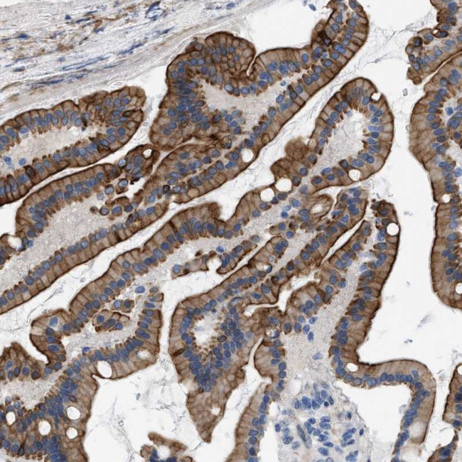 Nudel Antibody in Immunohistochemistry (Paraffin) (IHC (P))