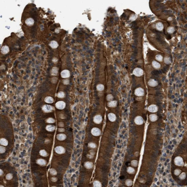 DNAJC28 Antibody in Immunohistochemistry (Paraffin) (IHC (P))