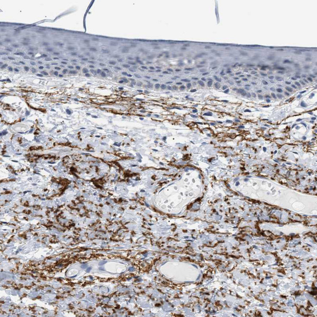 Elastin Antibody in Immunohistochemistry (Paraffin) (IHC (P))