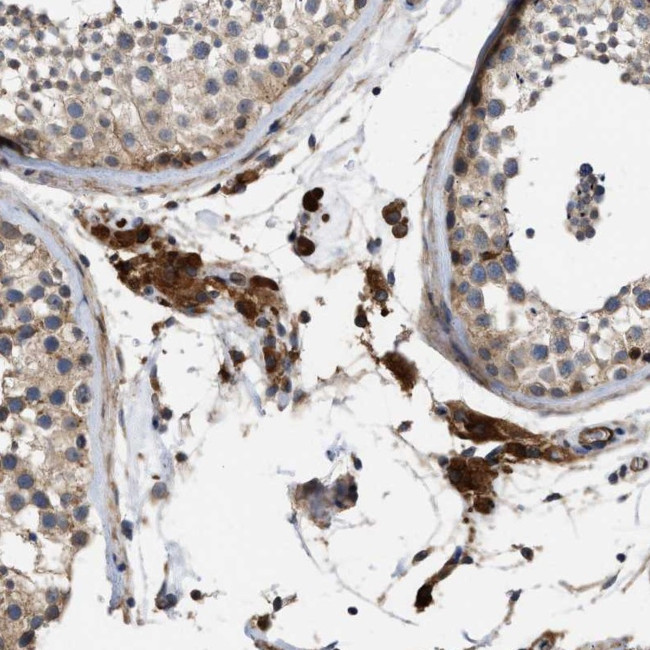 SLC4A11 Antibody in Immunohistochemistry (Paraffin) (IHC (P))