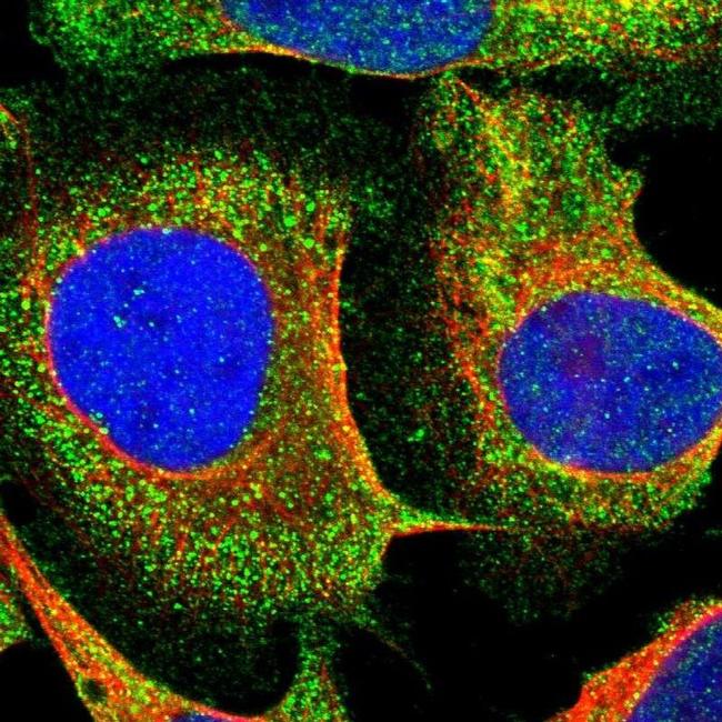 SMPD2 Antibody in Immunocytochemistry (ICC/IF)