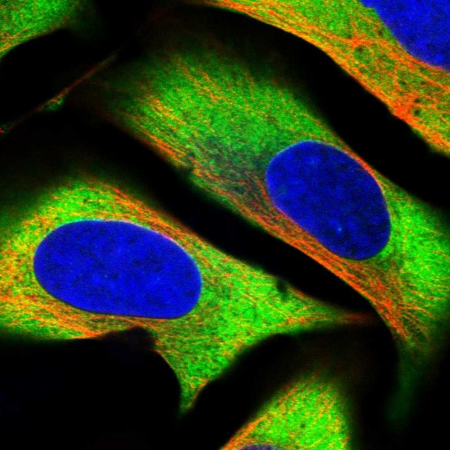 GPIP137 Antibody in Immunocytochemistry (ICC/IF)