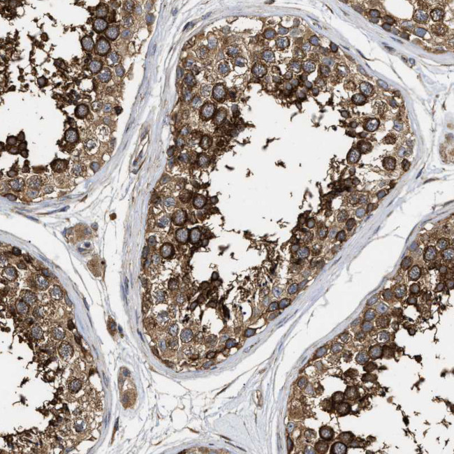 NAV1 Antibody in Immunohistochemistry (Paraffin) (IHC (P))