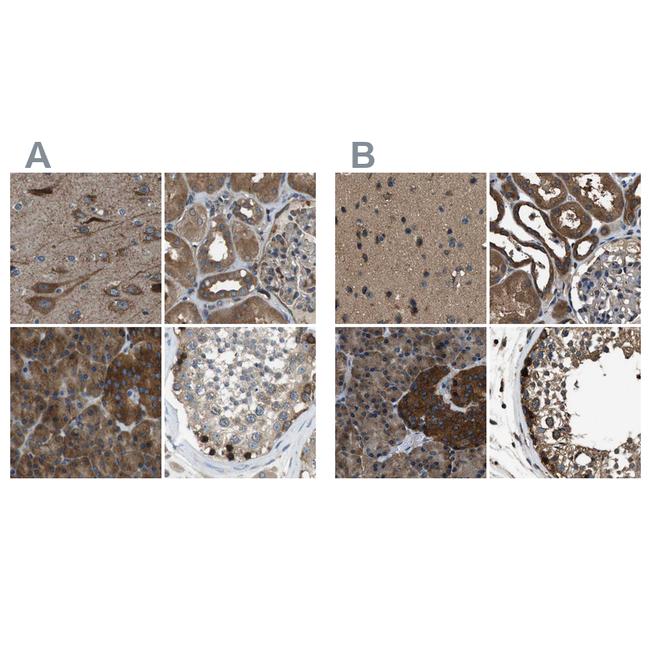 ARFGAP2 Antibody in Immunohistochemistry (IHC)