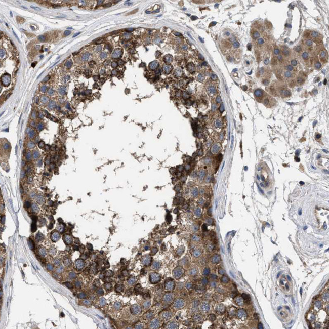 YBEY Antibody in Immunohistochemistry (Paraffin) (IHC (P))