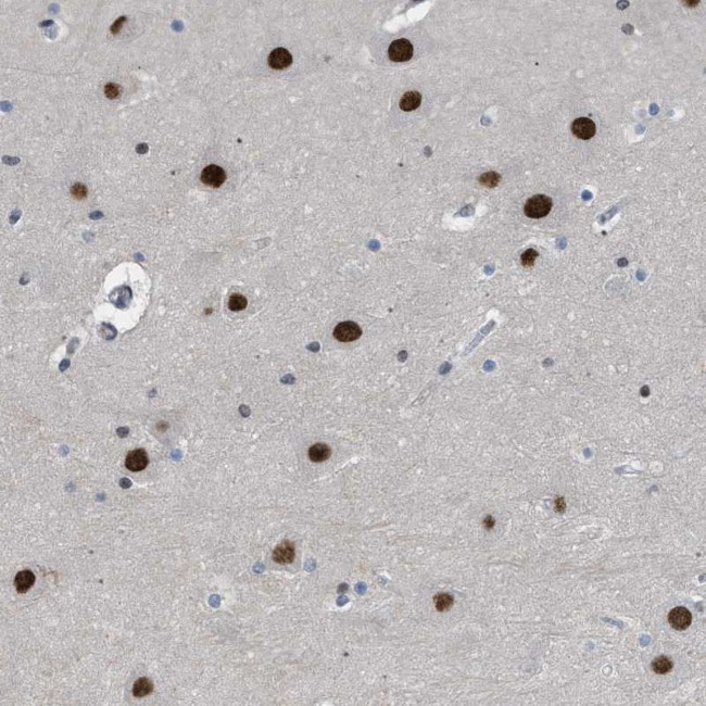 ENT2 Antibody in Immunohistochemistry (Paraffin) (IHC (P))