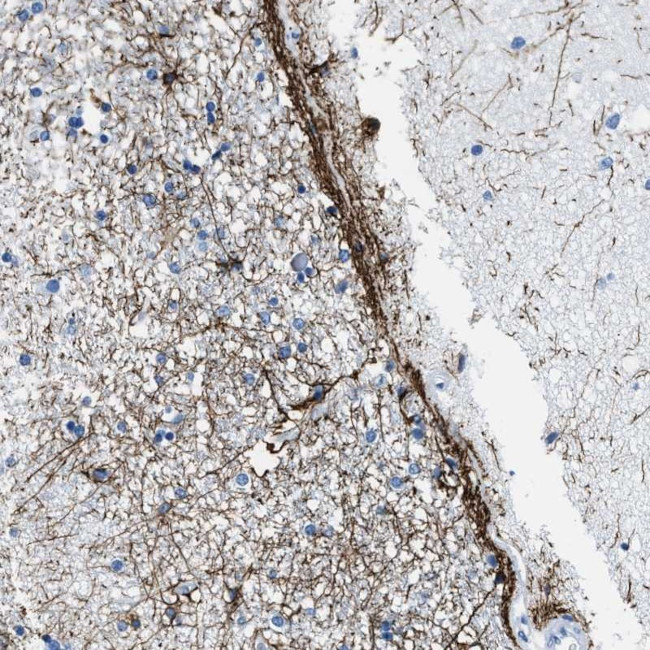 SLC30A4 Antibody in Immunohistochemistry (Paraffin) (IHC (P))