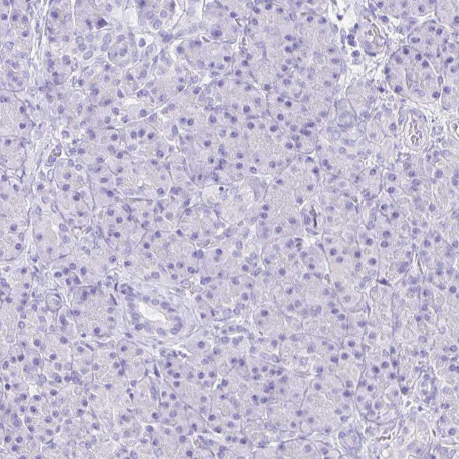 GUCA2A Antibody in Immunohistochemistry (Paraffin) (IHC (P))