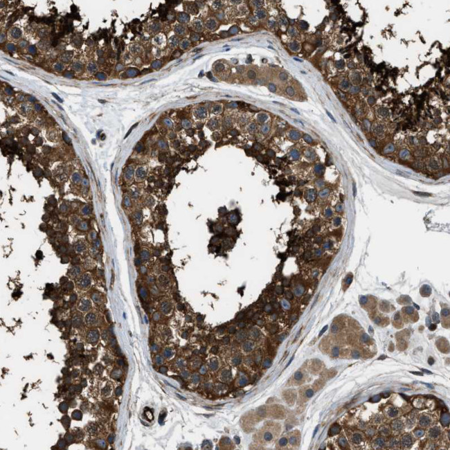 PFKP Antibody in Immunohistochemistry (Paraffin) (IHC (P))