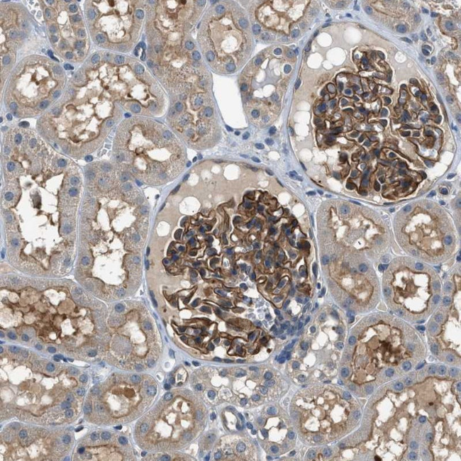 Cbl-b Antibody in Immunohistochemistry (Paraffin) (IHC (P))