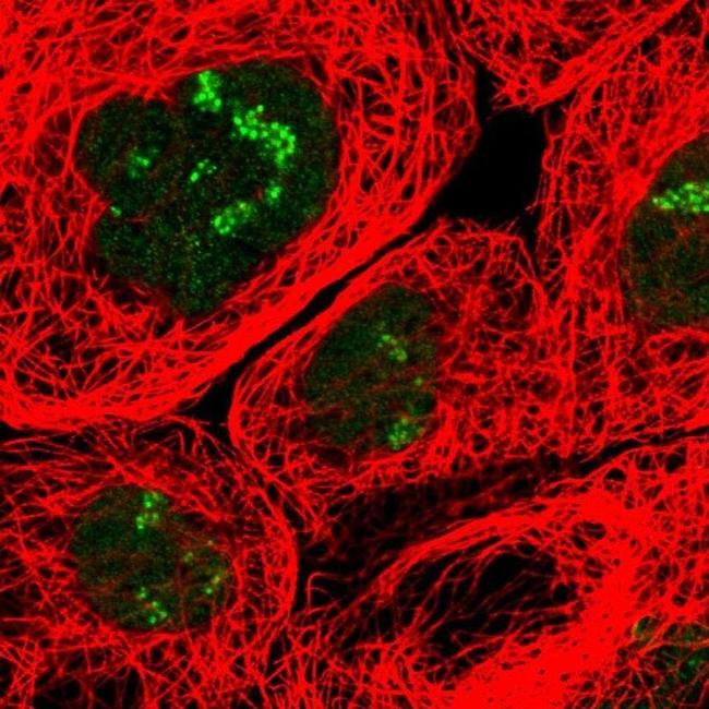 URB1 Antibody in Immunocytochemistry (ICC/IF)