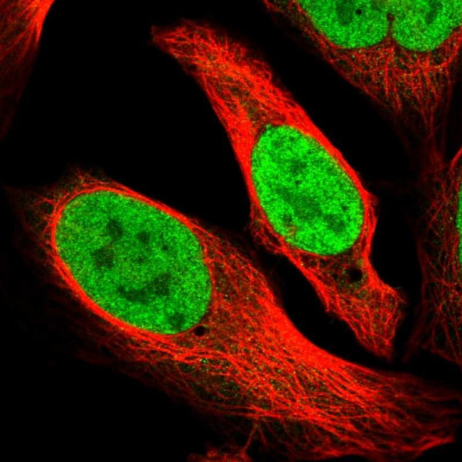 XPO5 Antibody in Immunocytochemistry (ICC/IF)