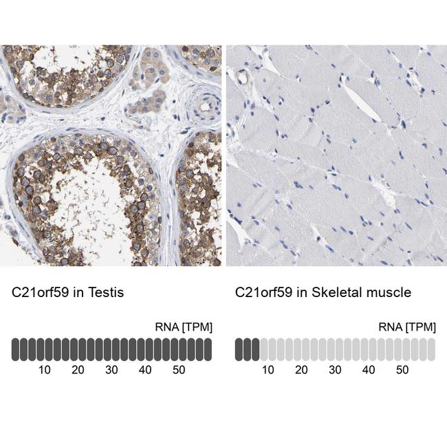 C21orf59 Antibody in Immunohistochemistry (IHC)