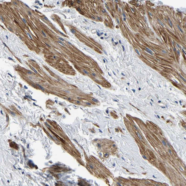 KCTD17 Antibody in Immunohistochemistry (Paraffin) (IHC (P))