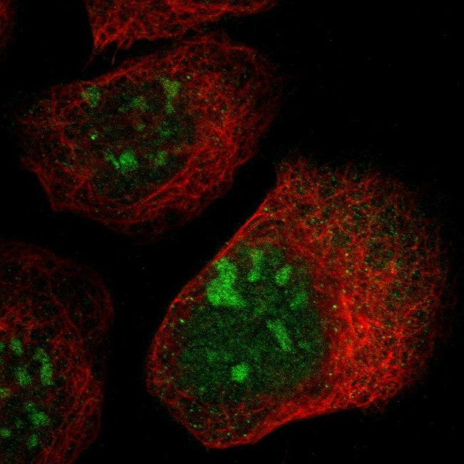 PPM1E Antibody in Immunocytochemistry (ICC/IF)