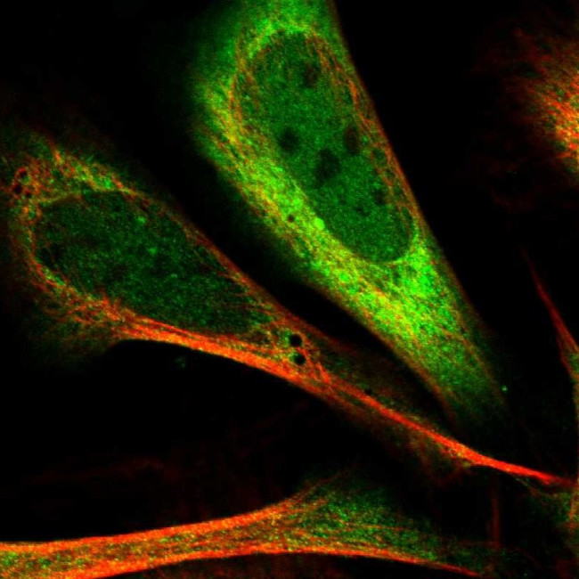 PDCL3 Antibody in Immunocytochemistry (ICC/IF)