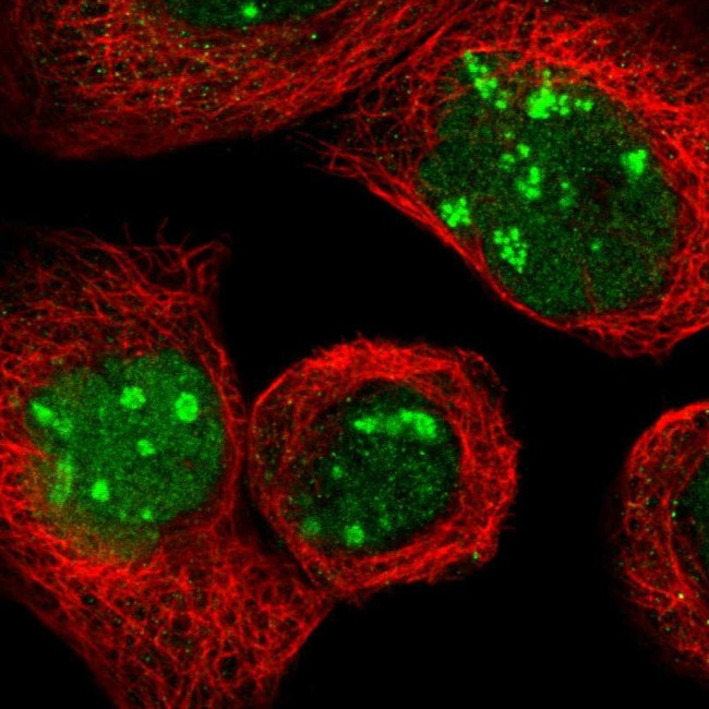 NOP58 Antibody in Immunocytochemistry (ICC/IF)