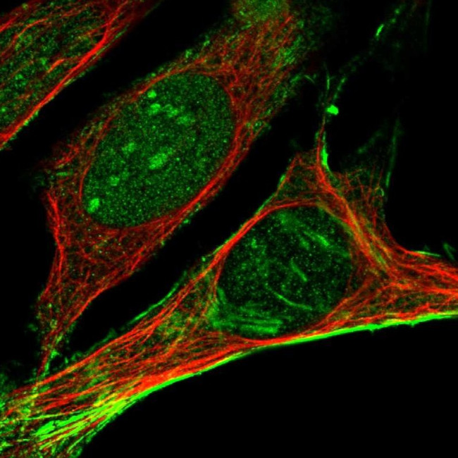 Septin 2 Antibody in Immunocytochemistry (ICC/IF)