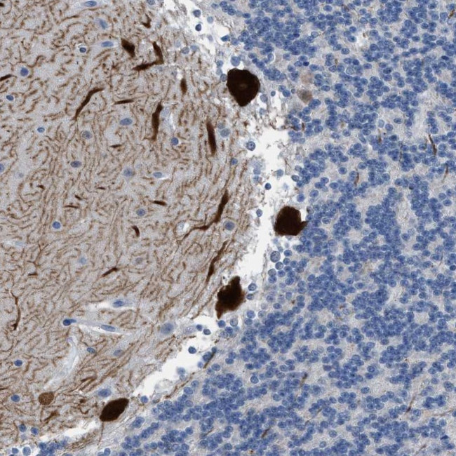 PDE1B Antibody in Immunohistochemistry (Paraffin) (IHC (P))