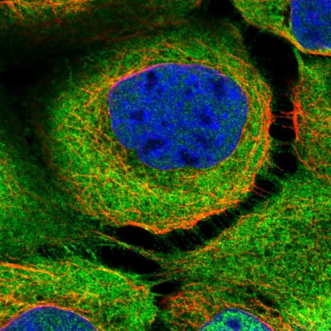 BAG3 Antibody in Immunocytochemistry (ICC/IF)