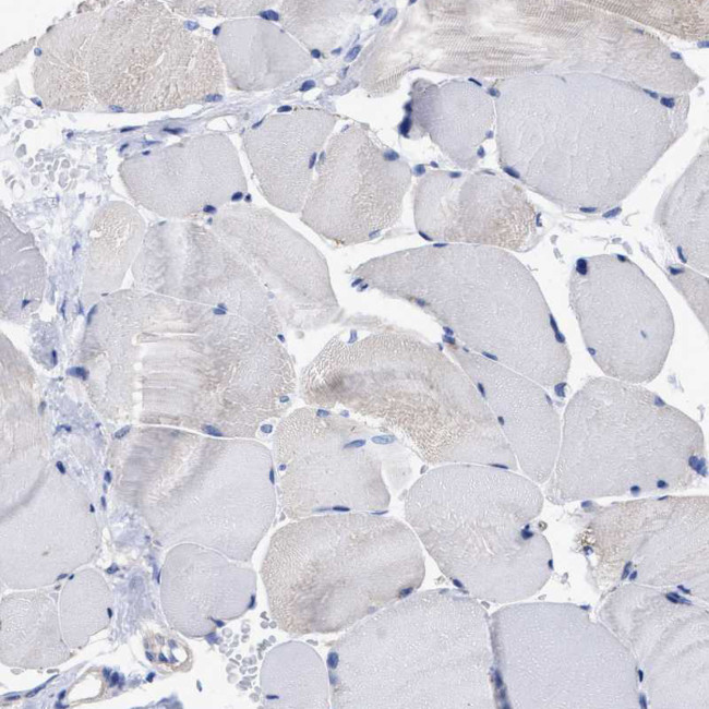 Lrmp Antibody in Immunohistochemistry (Paraffin) (IHC (P))