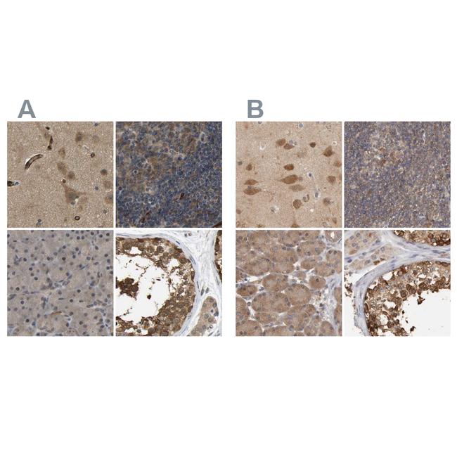 TCP-1 theta Antibody in Immunohistochemistry (IHC)