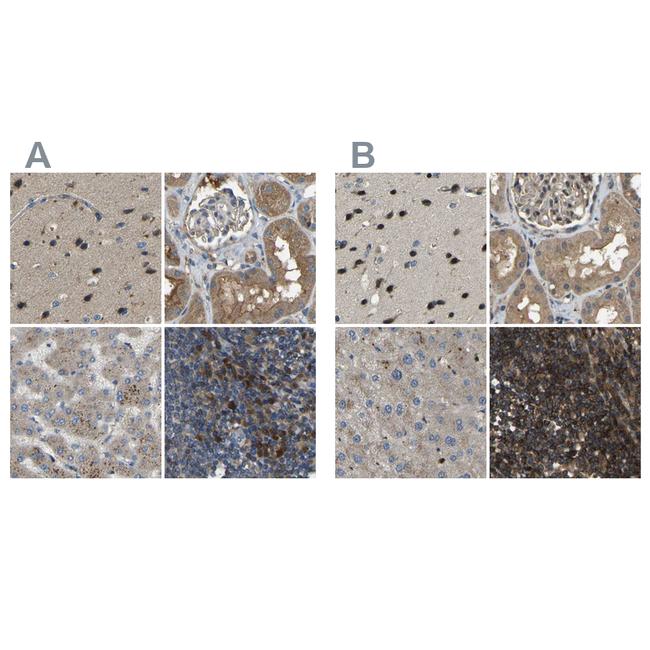 ATP8B1 Antibody in Immunohistochemistry (IHC)