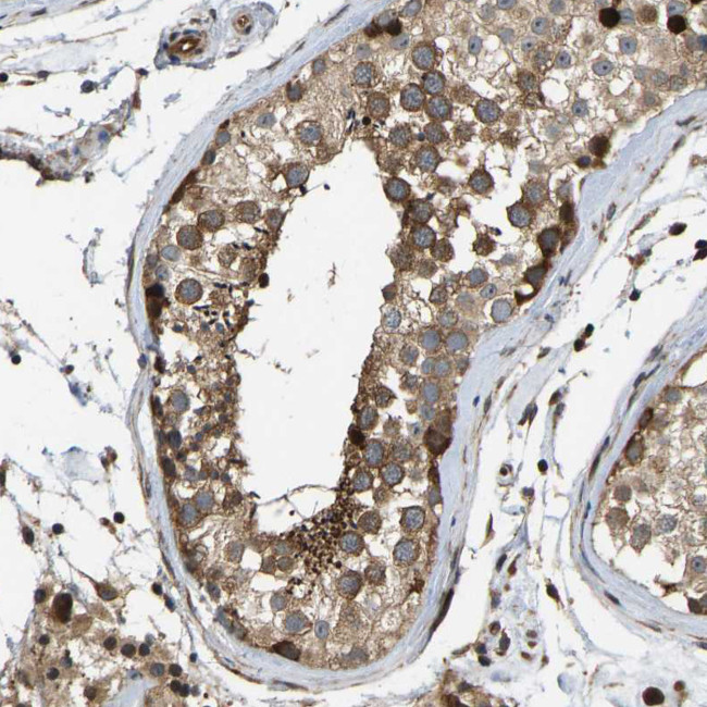 RASGRF2 Antibody in Immunohistochemistry (Paraffin) (IHC (P))