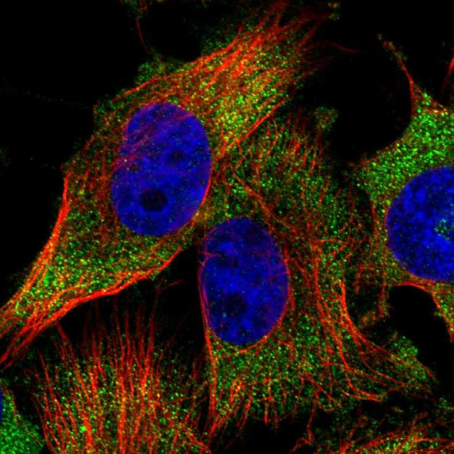 GCN1L1 Antibody in Immunocytochemistry (ICC/IF)