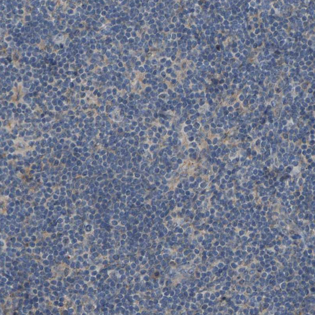 SLC43A1 Antibody in Immunohistochemistry (Paraffin) (IHC (P))