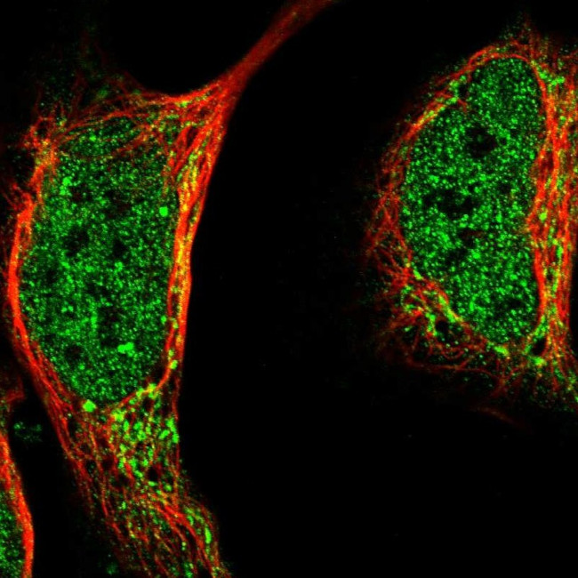 LIAS Antibody in Immunocytochemistry (ICC/IF)