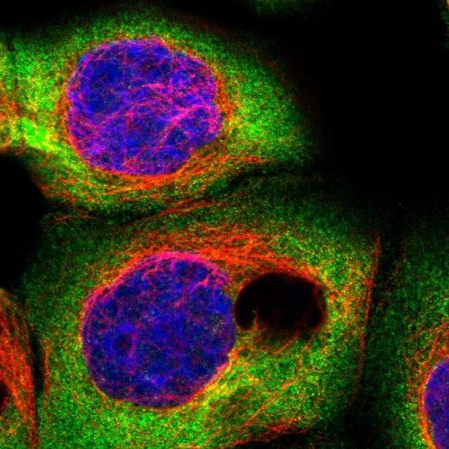 CSDE1 Antibody in Immunocytochemistry (ICC/IF)