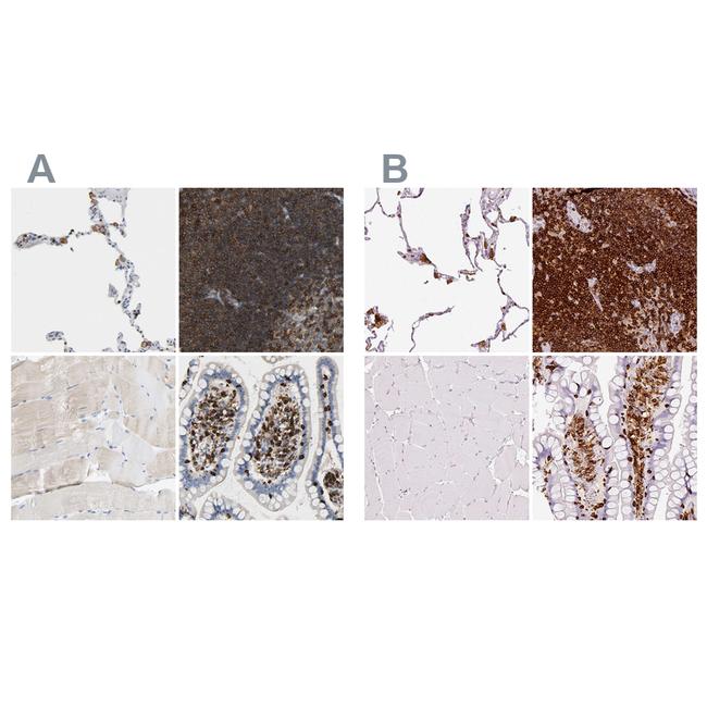 EVL Antibody in Immunohistochemistry (IHC)