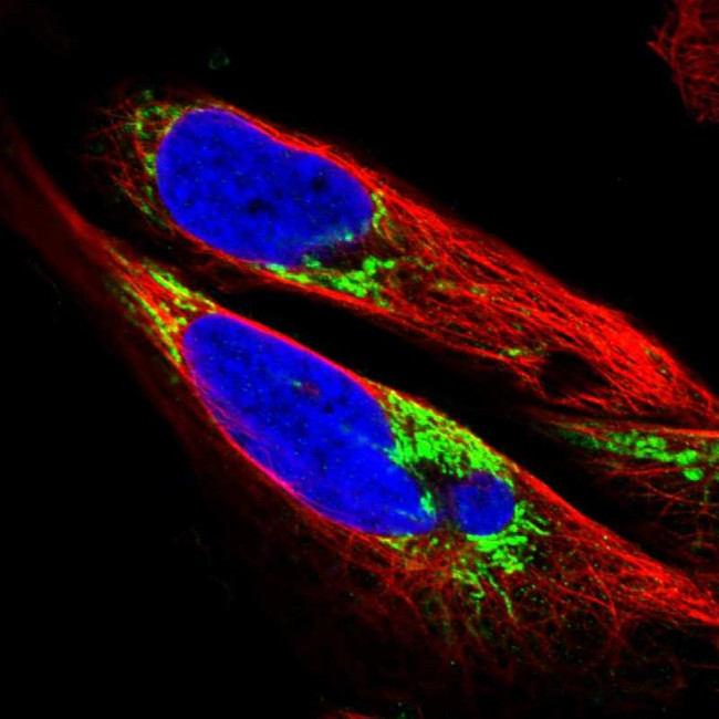 SLC25A13 Antibody in Immunocytochemistry (ICC/IF)