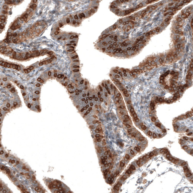 IL17RE Antibody in Immunohistochemistry (Paraffin) (IHC (P))