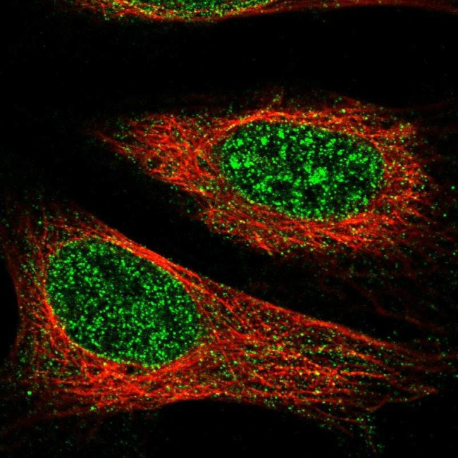 TET1 Antibody in Immunocytochemistry (ICC/IF)