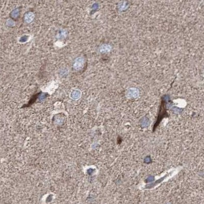 COBL Antibody in Immunohistochemistry (Paraffin) (IHC (P))