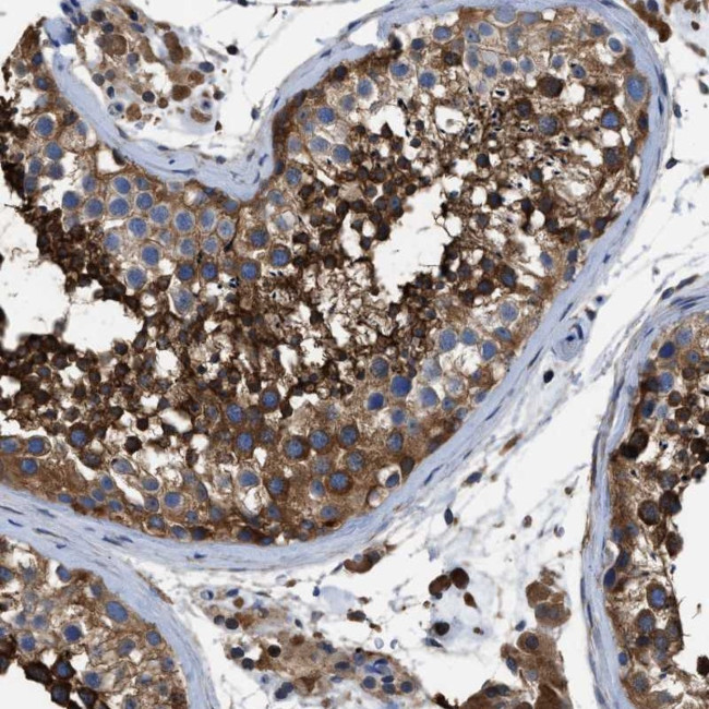 OR10S1 Antibody in Immunohistochemistry (Paraffin) (IHC (P))