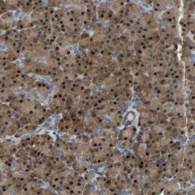 CROT Antibody in Immunohistochemistry (Paraffin) (IHC (P))