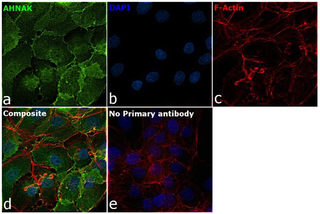 AHNAK Antibody in Immunocytochemistry (ICC/IF)