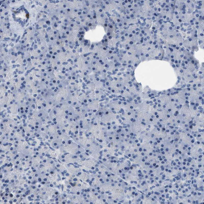 CRYM Antibody in Immunohistochemistry (Paraffin) (IHC (P))