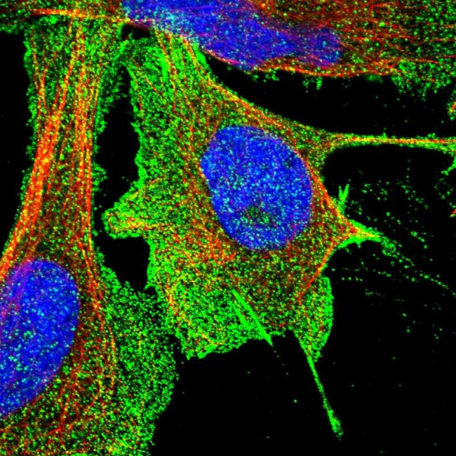 Aquaporin 1 Antibody in Immunocytochemistry (ICC/IF)