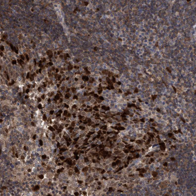 SLBP Antibody in Immunohistochemistry (Paraffin) (IHC (P))