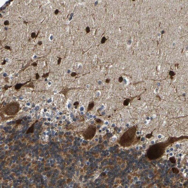 PPM1E Antibody in Immunohistochemistry (IHC)