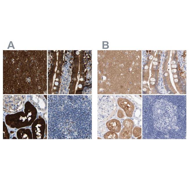 GDA Antibody in Immunohistochemistry (IHC)