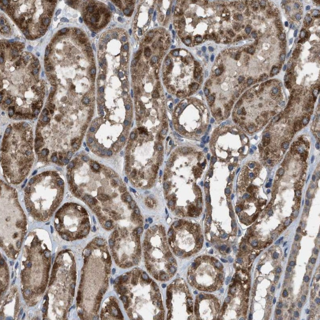 ARL6 Antibody in Immunohistochemistry (Paraffin) (IHC (P))