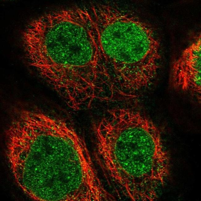 EOGT Antibody in Immunocytochemistry (ICC/IF)